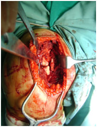 orthopedic doctor in paldi